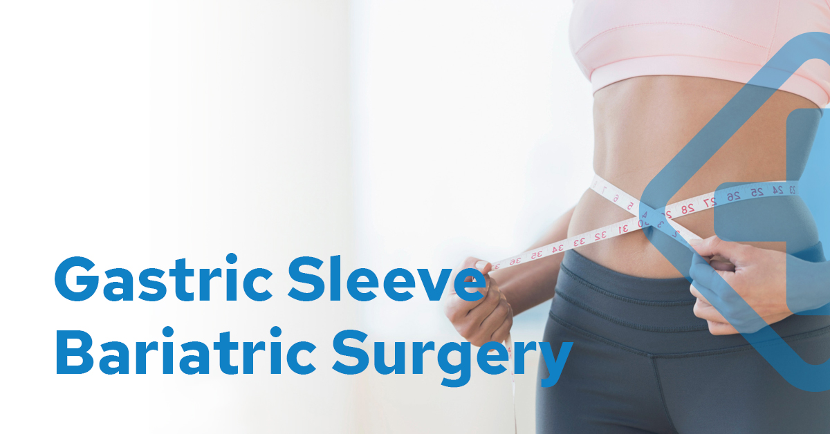 What is a gastric sleeve?