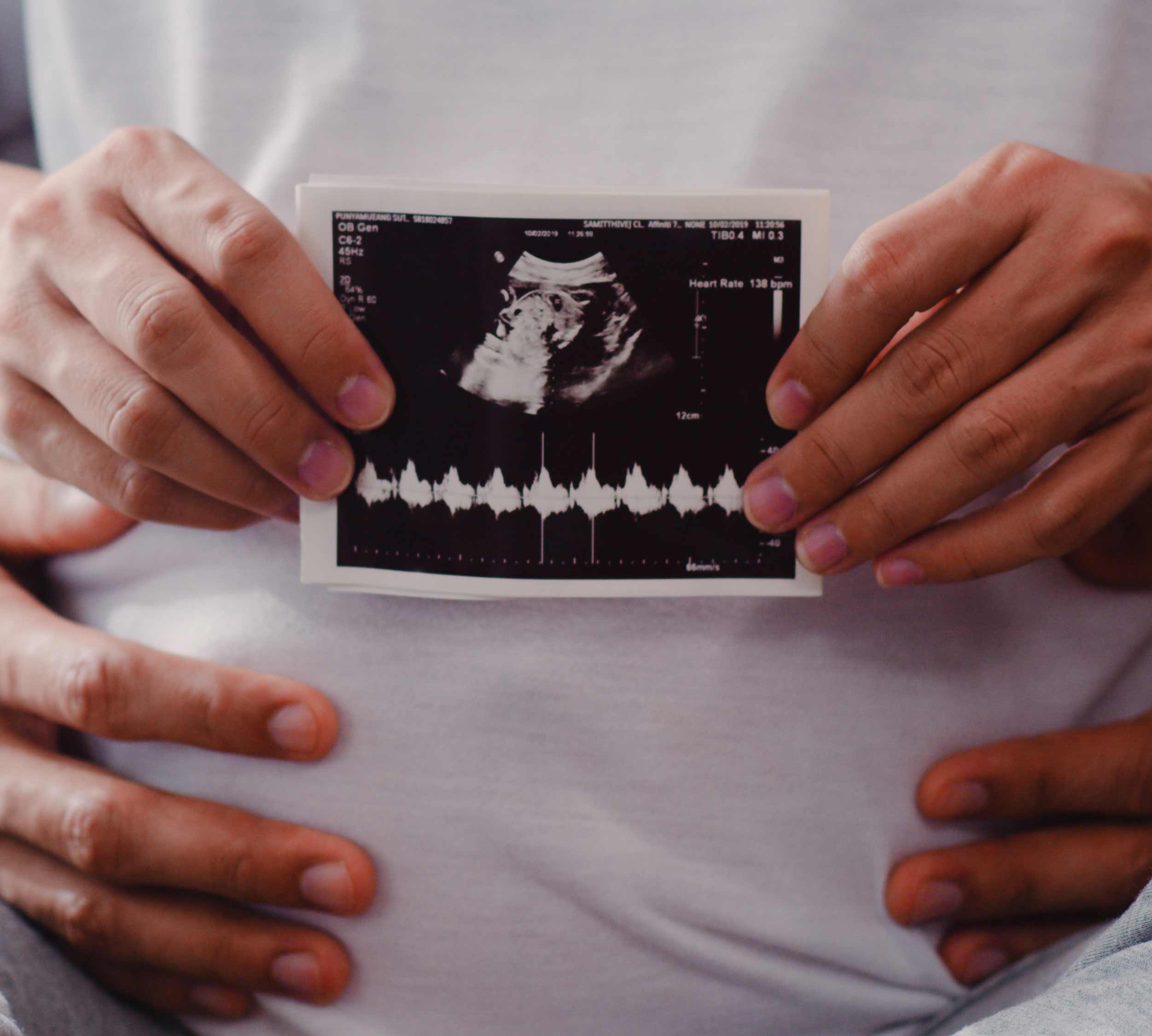 Prenatal-care: What Is and Why is Important ...