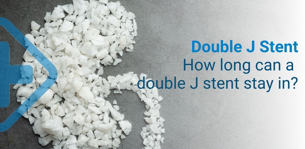 Double J Stent: Before, During and After Surgery