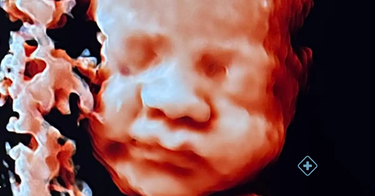See Your Baby Before Birth: 4D and 5D Ultrasound