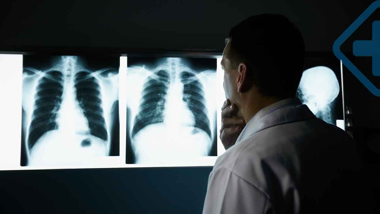 What do lungs do?