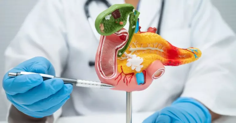 Pancreatitis: Symptoms, Causes, Treatment, and Risks