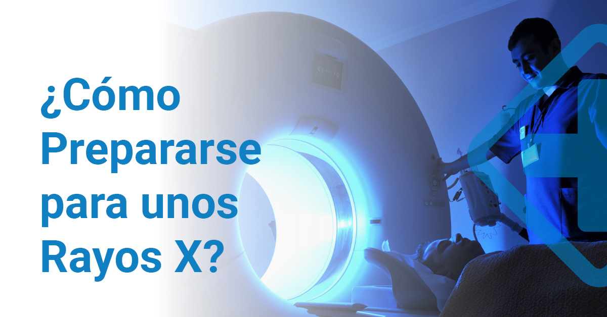 ¿Cómo prepararse para unos rayos x?
