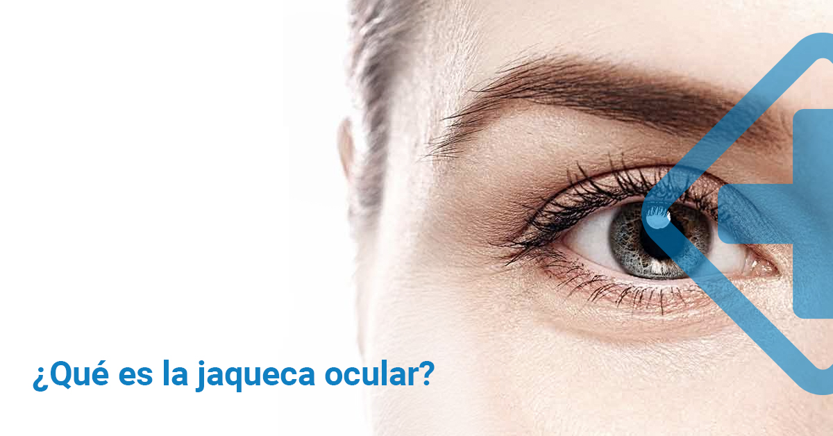 ¿Qué es la jaqueca ocular?