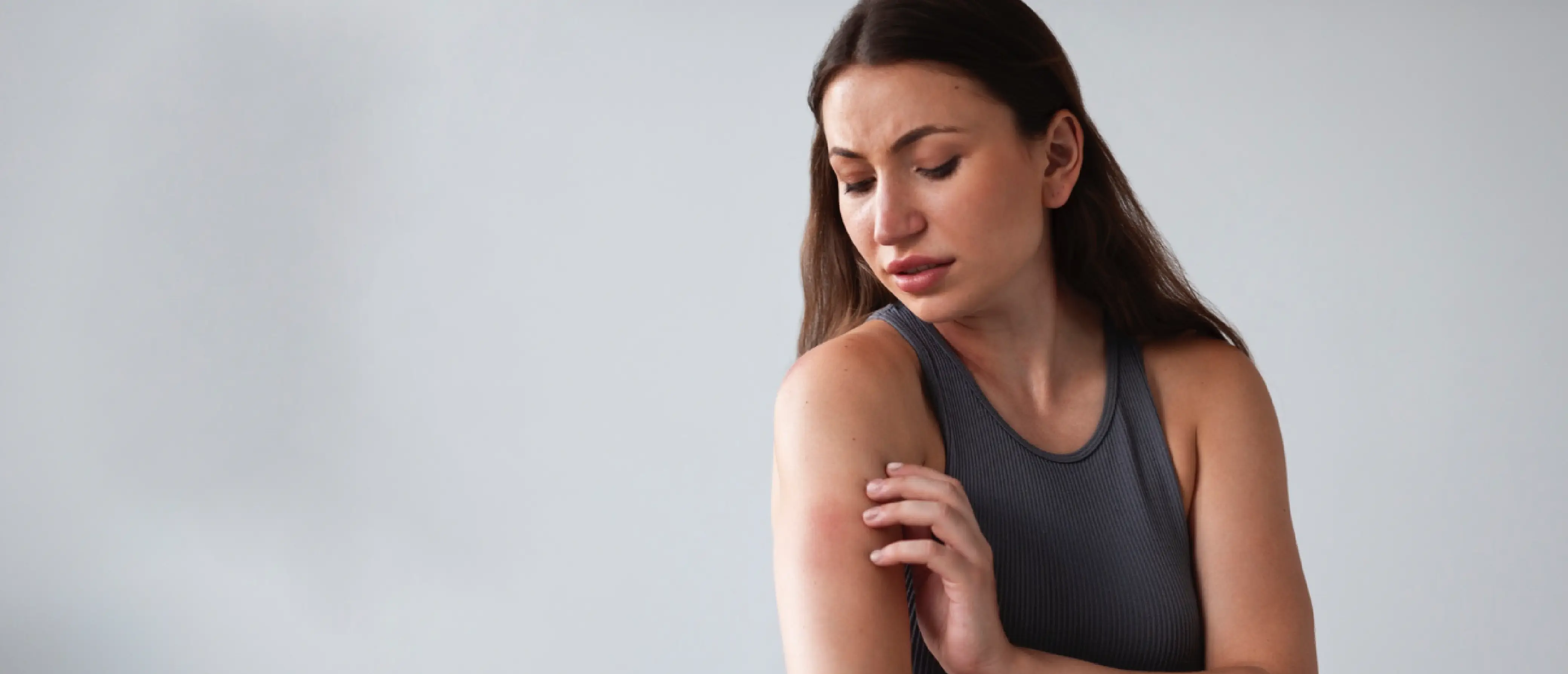¿Alergia al sol? ¡Esto es lo que necesitas saber!