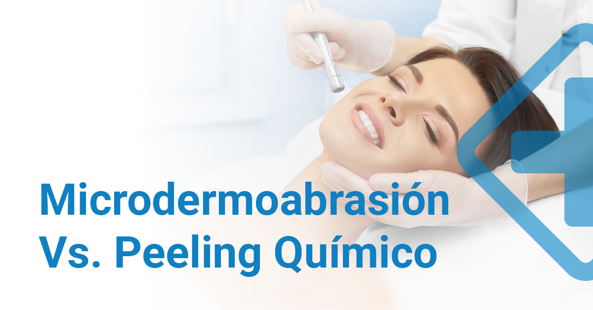 Microdermabrasión vs. Peeling Químico