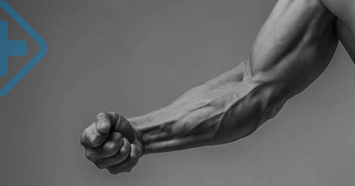 ¿Brazo de Popeye? ¡No es normal!