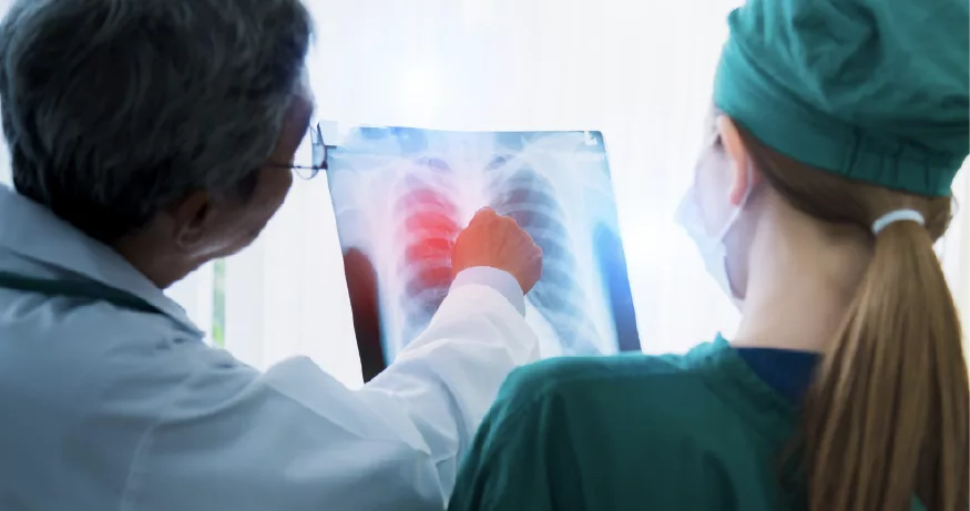 i-v