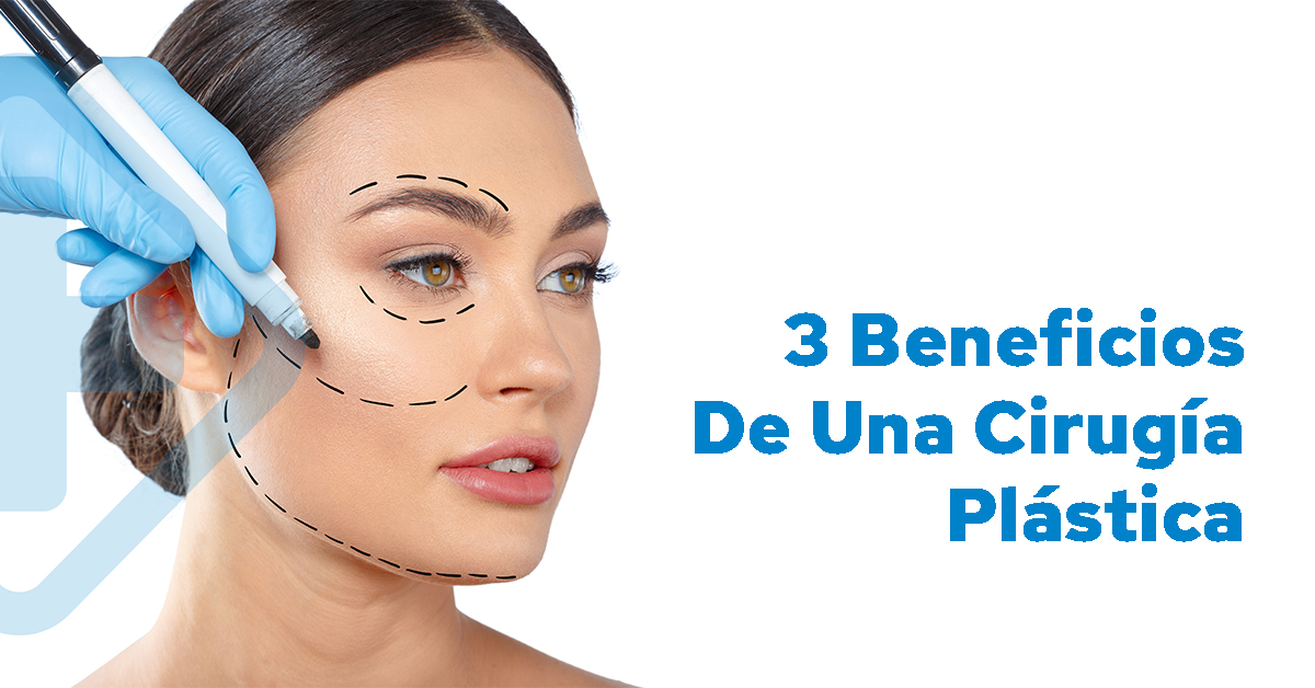 3 beneficios de una cirugía plástica